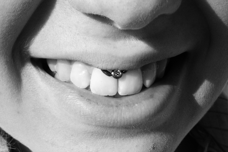 Smiley piercing