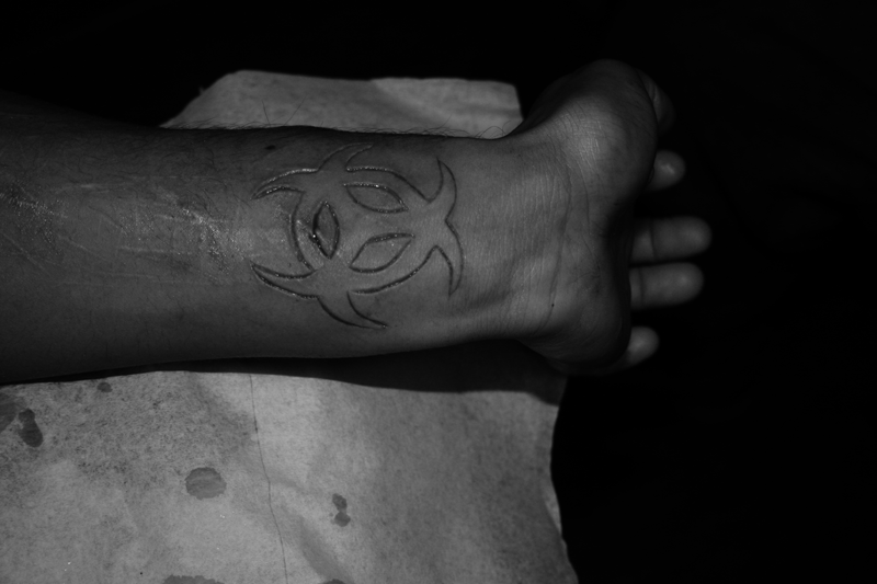 Scarification art