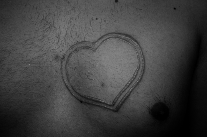 Scarification art