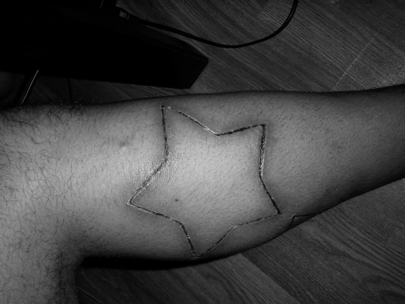 Scarification art