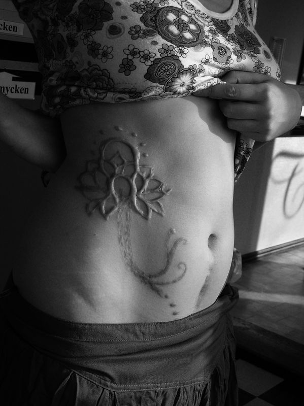 Scarification art
