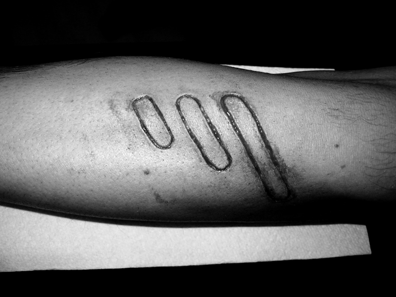 Scarification art