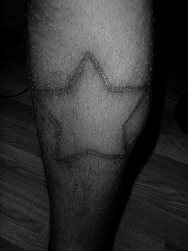 Scarification art